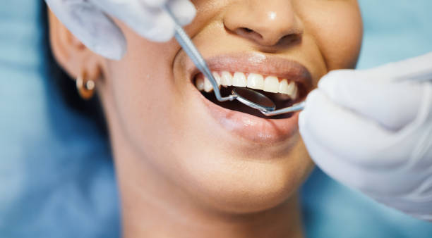 Best Same-Day Emergency Dentist in Vaughn, WA