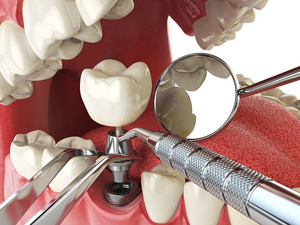 Best Walk-In Emergency Dentist in Vaughn, WA